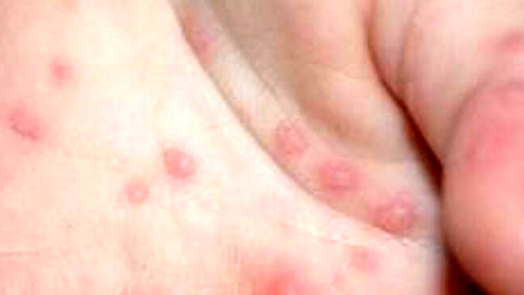 influenza-del-pomodoro-bolle-rosse-2.jpg