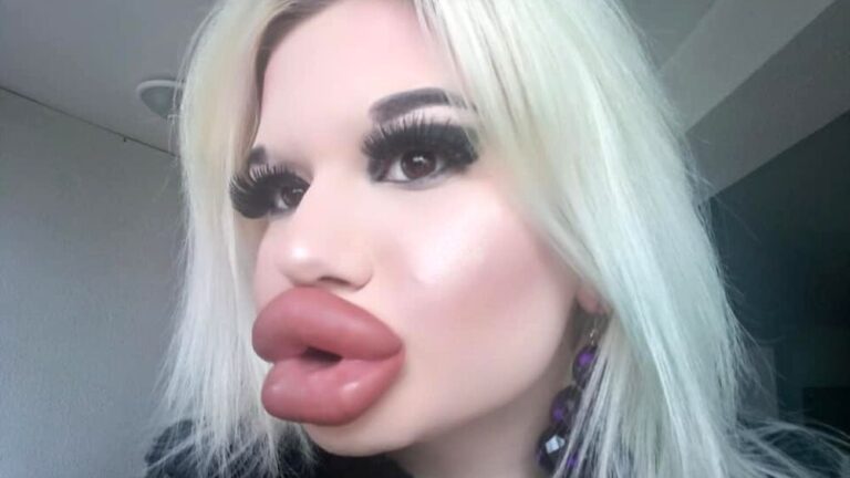 1666642112_donna-labbra-mondo-2.jpg