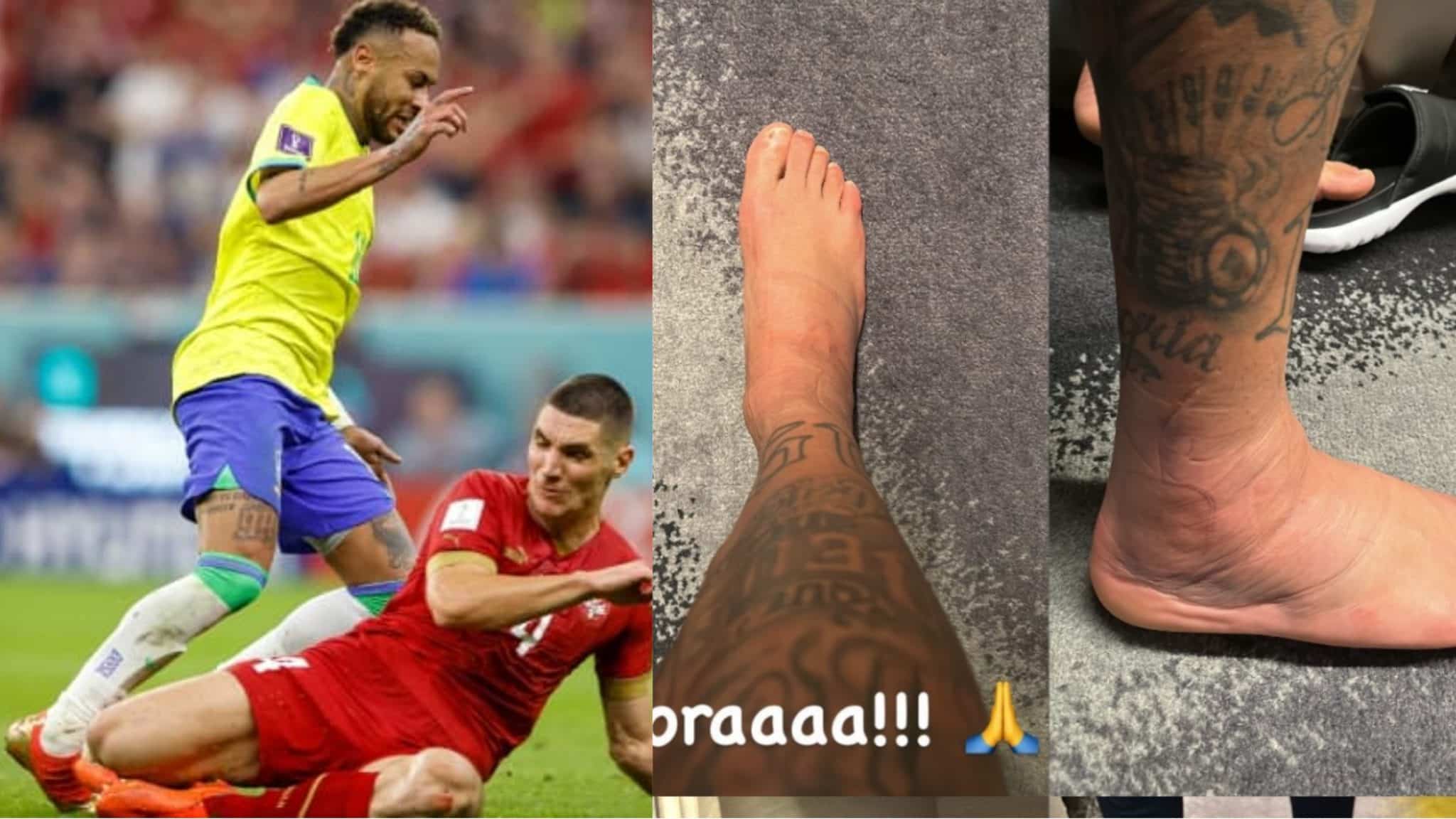 Neymar n&rsquo;a pas encore surmonté le choc avec Milenkovic, montre sa cheville enflée sur Instagram