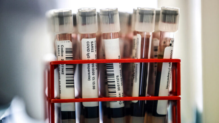 test-sierologici-ansa-coronavirus-2.jpg