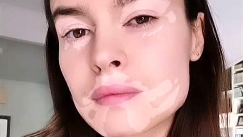 Instagram, Kasia Smutniak lance un filtre qui simule le vitiligo