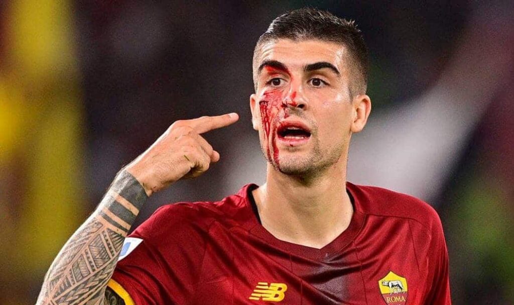 mancini-sangue-roma-udinese-2-1-1.jpg